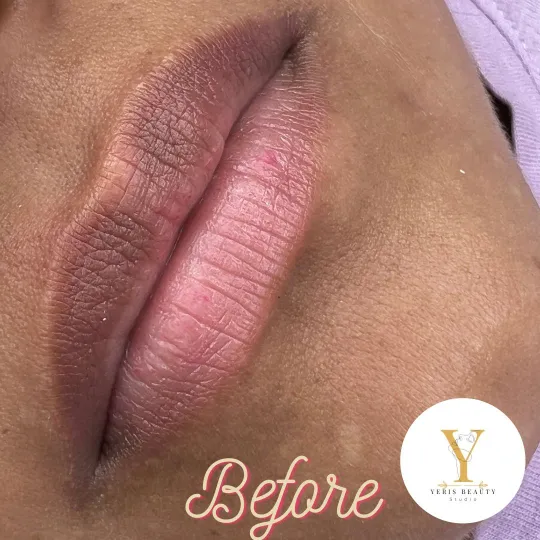 Permanent Makeup Lip Neutralization